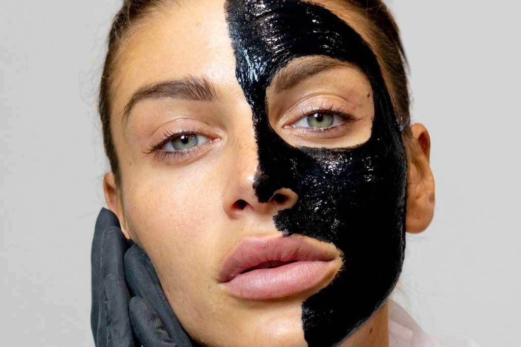 Step into a New Glow with Laser Carbon Peel Treatment