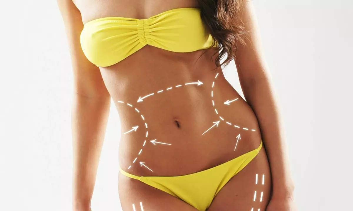 Body Sculpting Treatment Your Slimming Solution