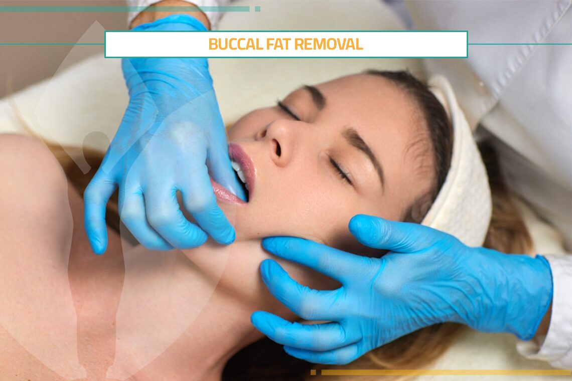 Buccal Fat Removal for Elegant, Sharp Cheekbones