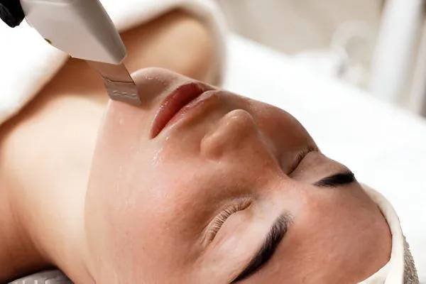 Why You Should Try a Chemical Peel Facial Treatment in Coquitlam This Season