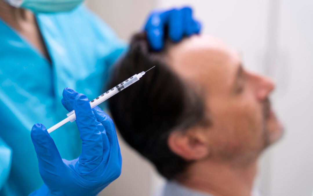 Tips to Maximize Results After PRP Treatment for Beard Growth