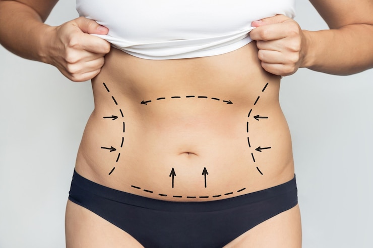 Does Metabolic Support Treatment Cure Diabetes?