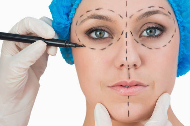 Does a Facelift  Leave Scars
