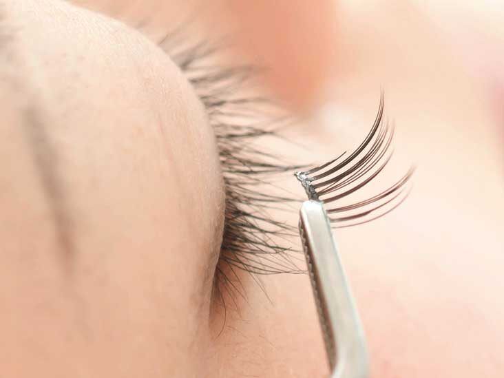 Eyelash Transplant SafetyWhat You Should Know Before You Go