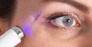 What Are the Benefits of Laser for Scar Revision?