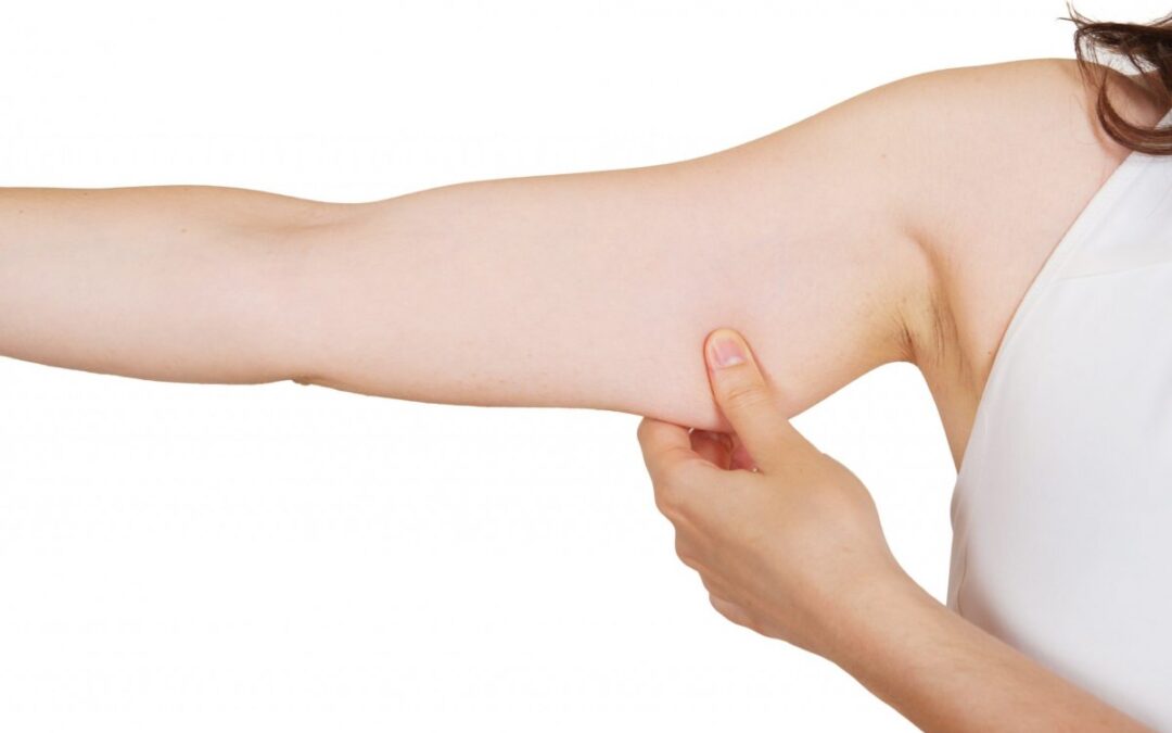 How Scarring Is Managed After an Arm Lift Procedure