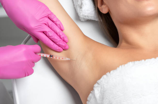How to Prepare for Botox Injections for Sweaty Glands ?