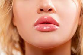 What’s the Cost of Lip Filler Injections?