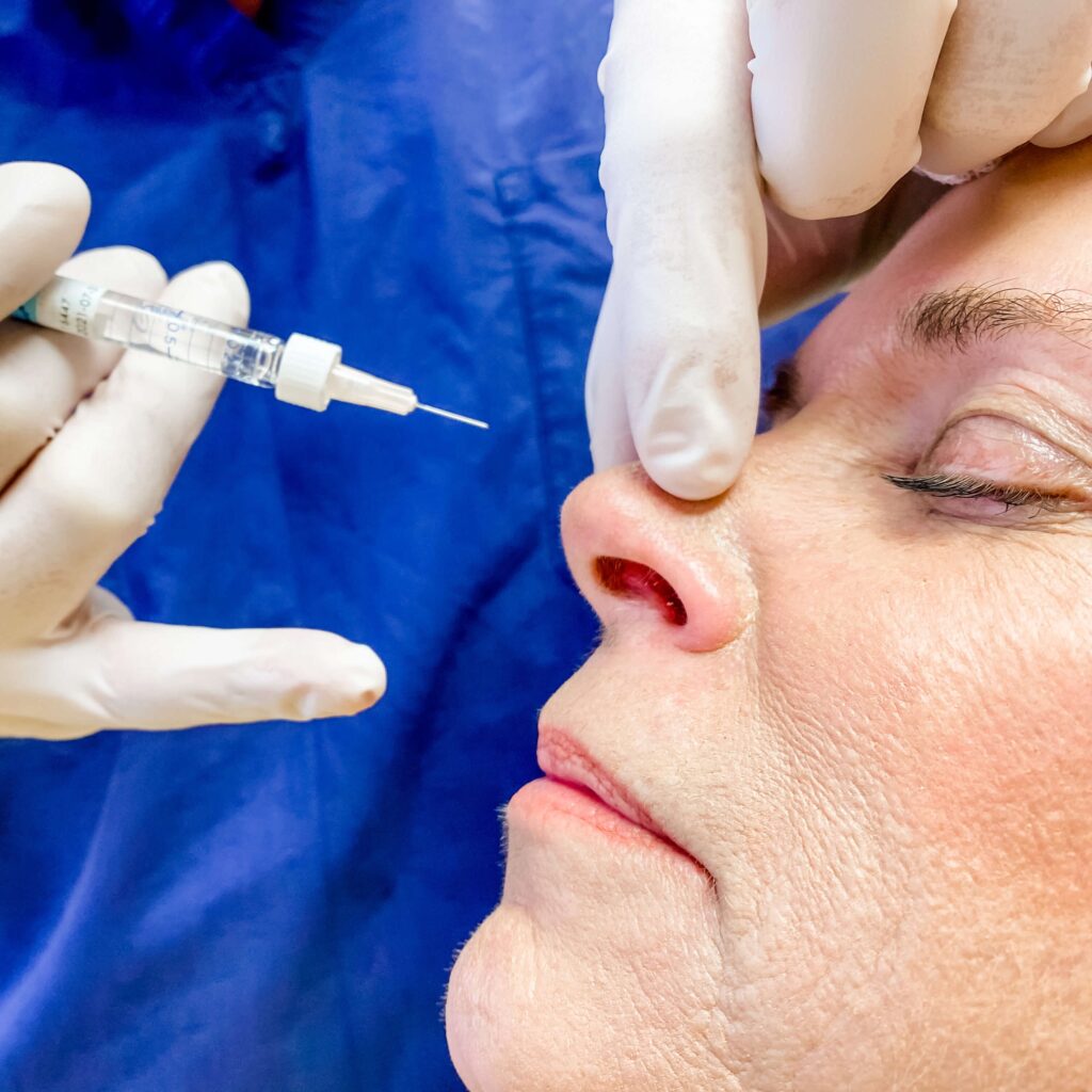Is Liquid Rhinoplasty Right for You