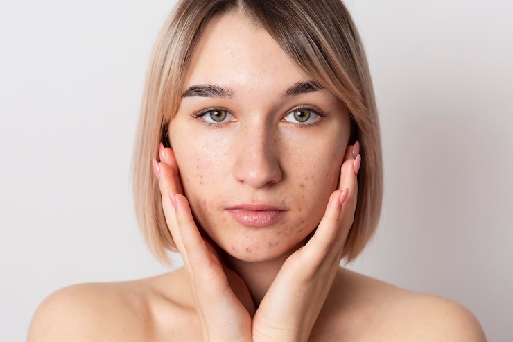 Is Pigmentation Treatment Abu Dhabi Worth It