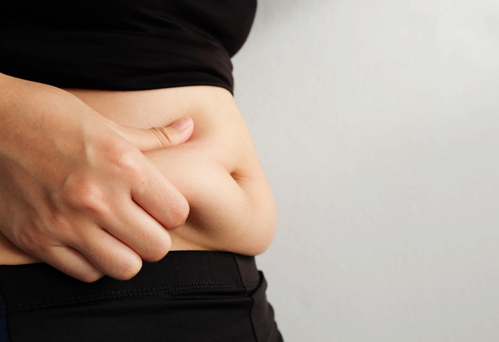 Why You Should Combine Liposuction with Healthy Living?