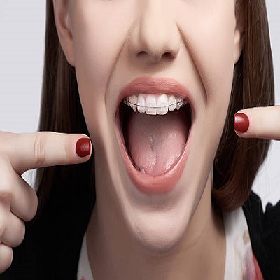 Protruding Teeth in Riyadh