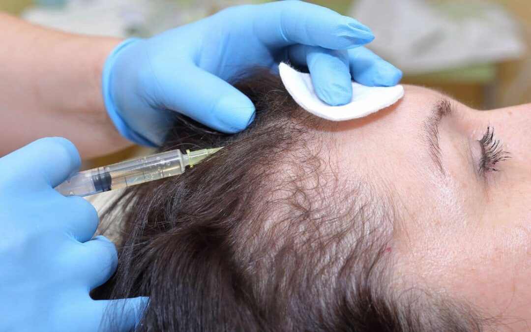 Real Results from PRP Hair Treatment