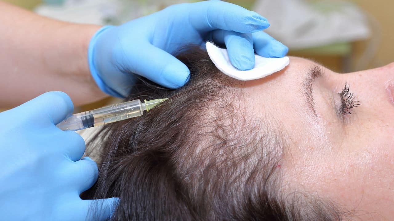 Real Results from PRP Hair Treatment