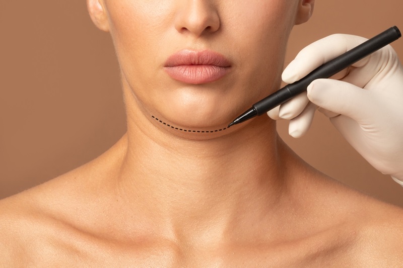 The Ultimate Guide to Double Chin Removal in 2025