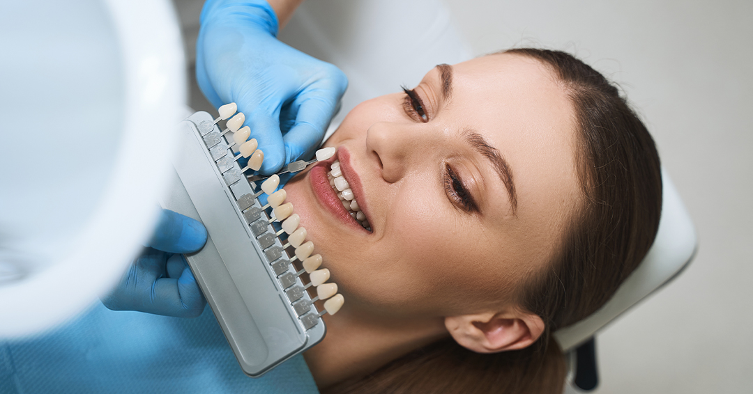 Top Trends in Cosmetic Dentistry: The Rise of E-max Veneers