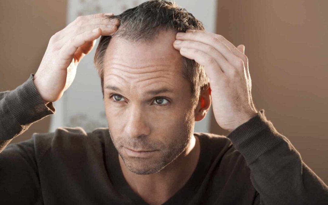What Are the Latest Innovations in Hair Replacement?