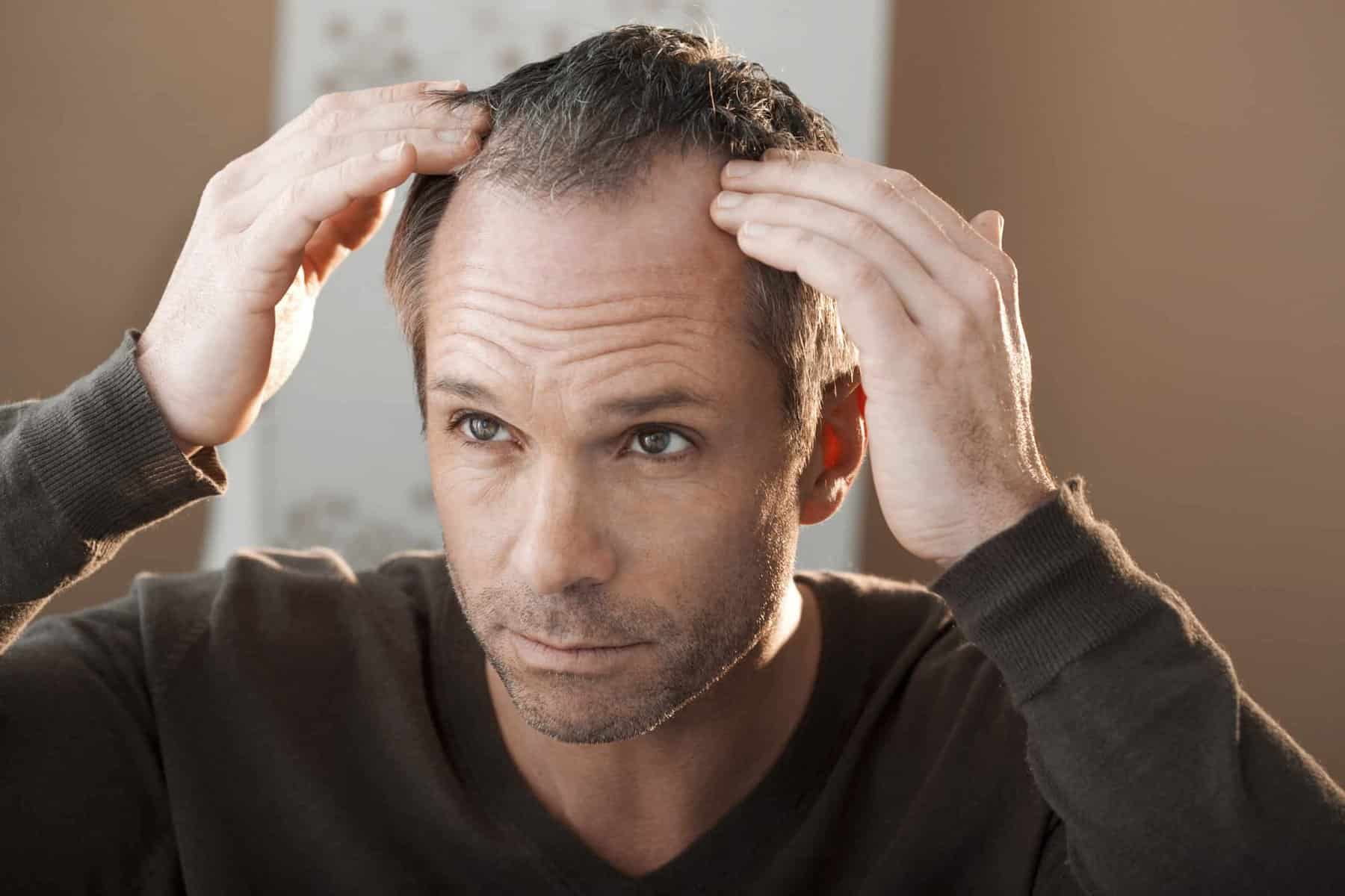 What Are the Latest Innovations in Hair Replacement