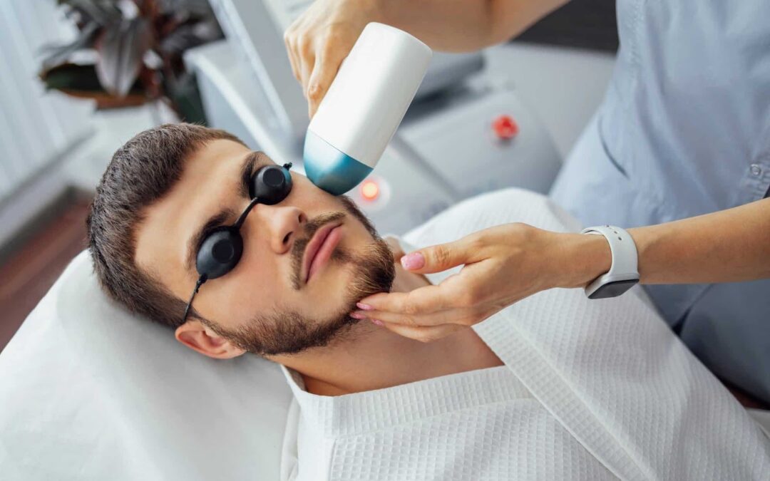 What Makes Beard Laser Hair Removal Popular?