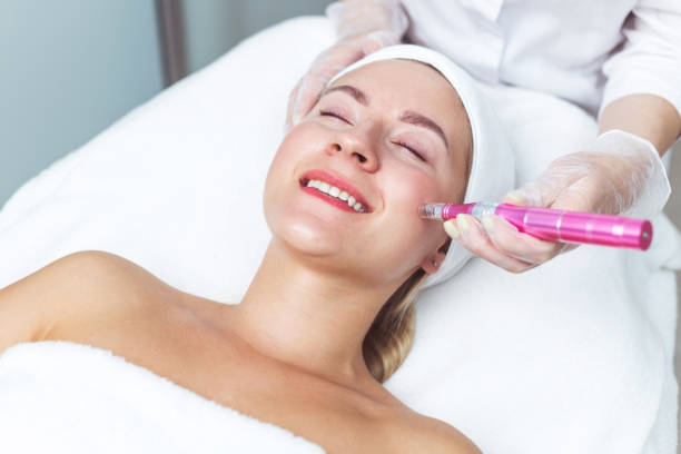What Skin Types Suit RF Microneedling?