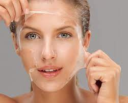 Can Chemical Peels Remove Scars Completely?