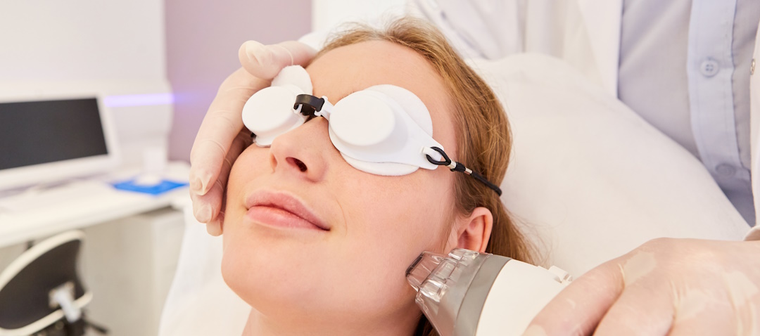 Can You Go in the Sun After CO2 Laser? Here’s What to Know