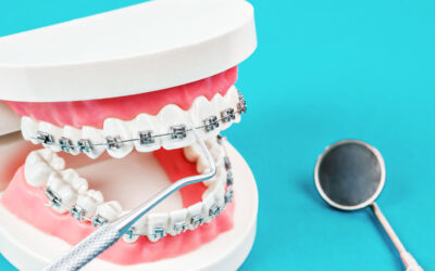 Common Mistakes People Make With Their Dental Appliances