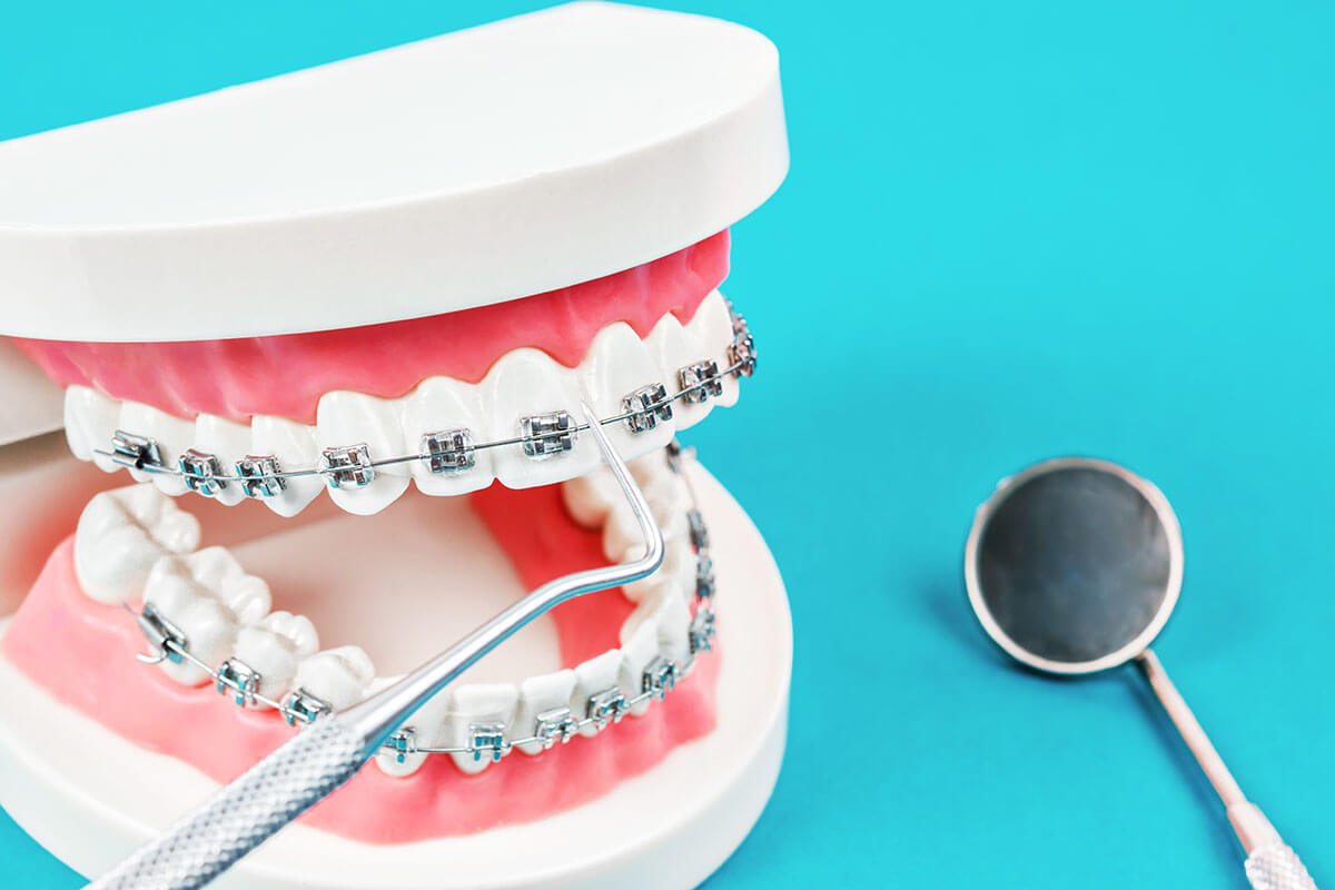 Common Mistakes People Make With Their Dental Appliances
