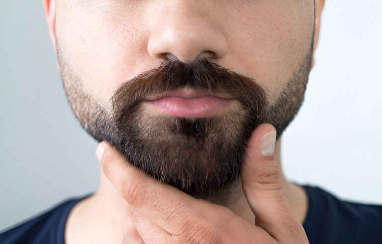 Does Beard Hair Transplant Work for All Skin Types