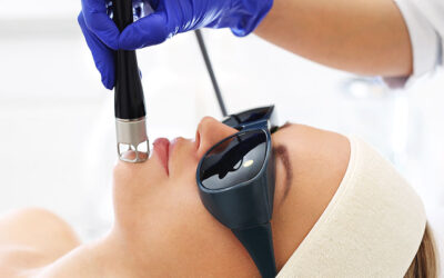 Does CO2 Laser Treatment Leave Any Scars?