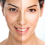 Facelift in Riyadh