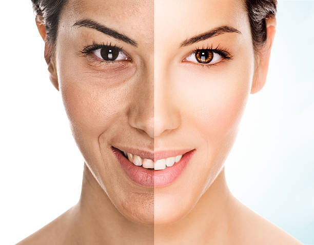 Top Questions to Ask Before Your Facelift Consultation