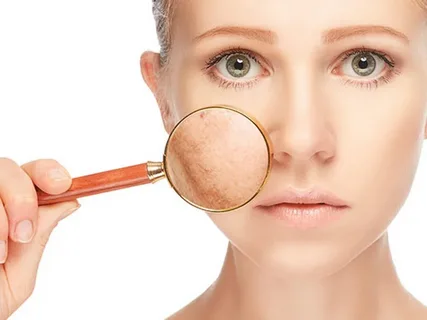 Facial scar revision