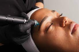 How Does HydraFacial Work for Aging Skin?