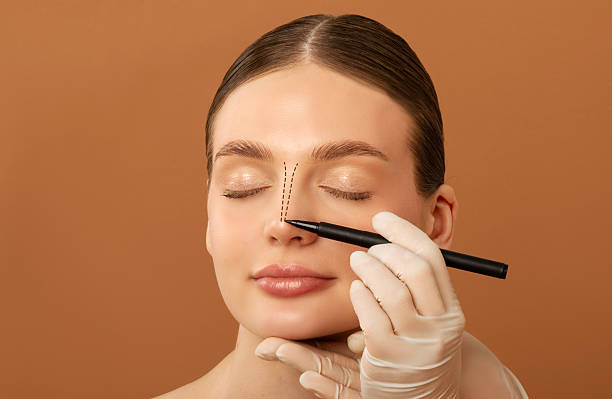 How Long Does Rhinoplasty  Take