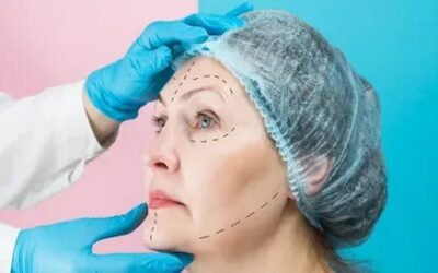 How Long Does the Best Plastic Surgeon Take?