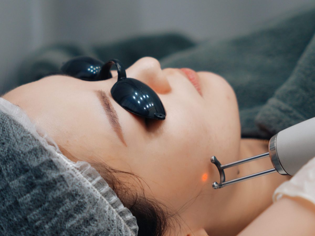 How Safe Is Pico Laser Treatment for the Face