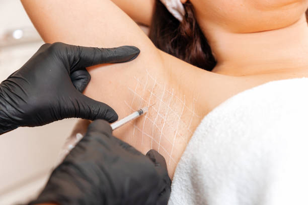 How to Prepare for Botox Injections for Sweaty Glands ?