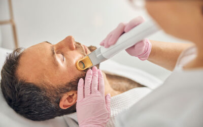 Is Beard Laser Hair Removal a One-Time Thing?