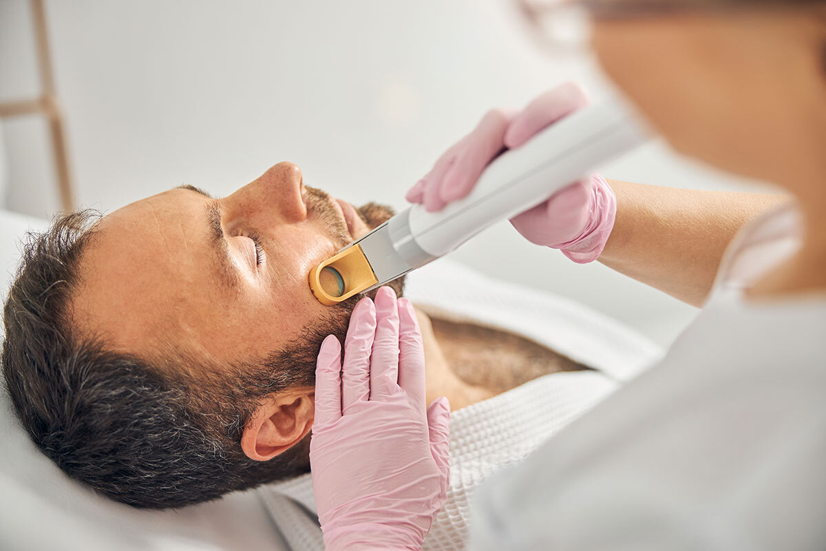 Is Beard Laser Hair Removal a One-Time Thing