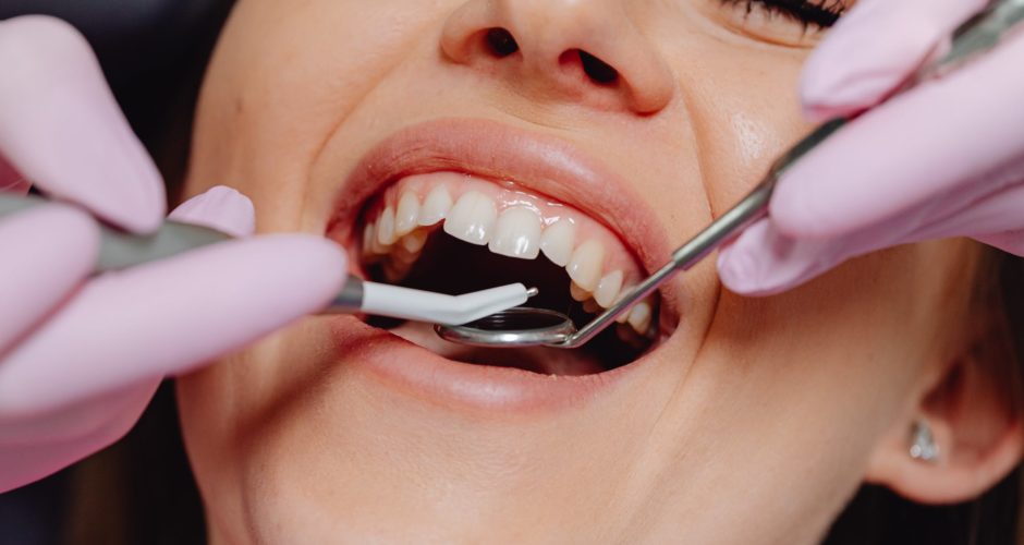 Is Gingivectomy Safe for Diabetic Patients?