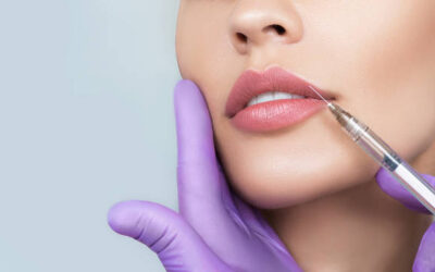 Is Russian Lip Fillers Right for You?