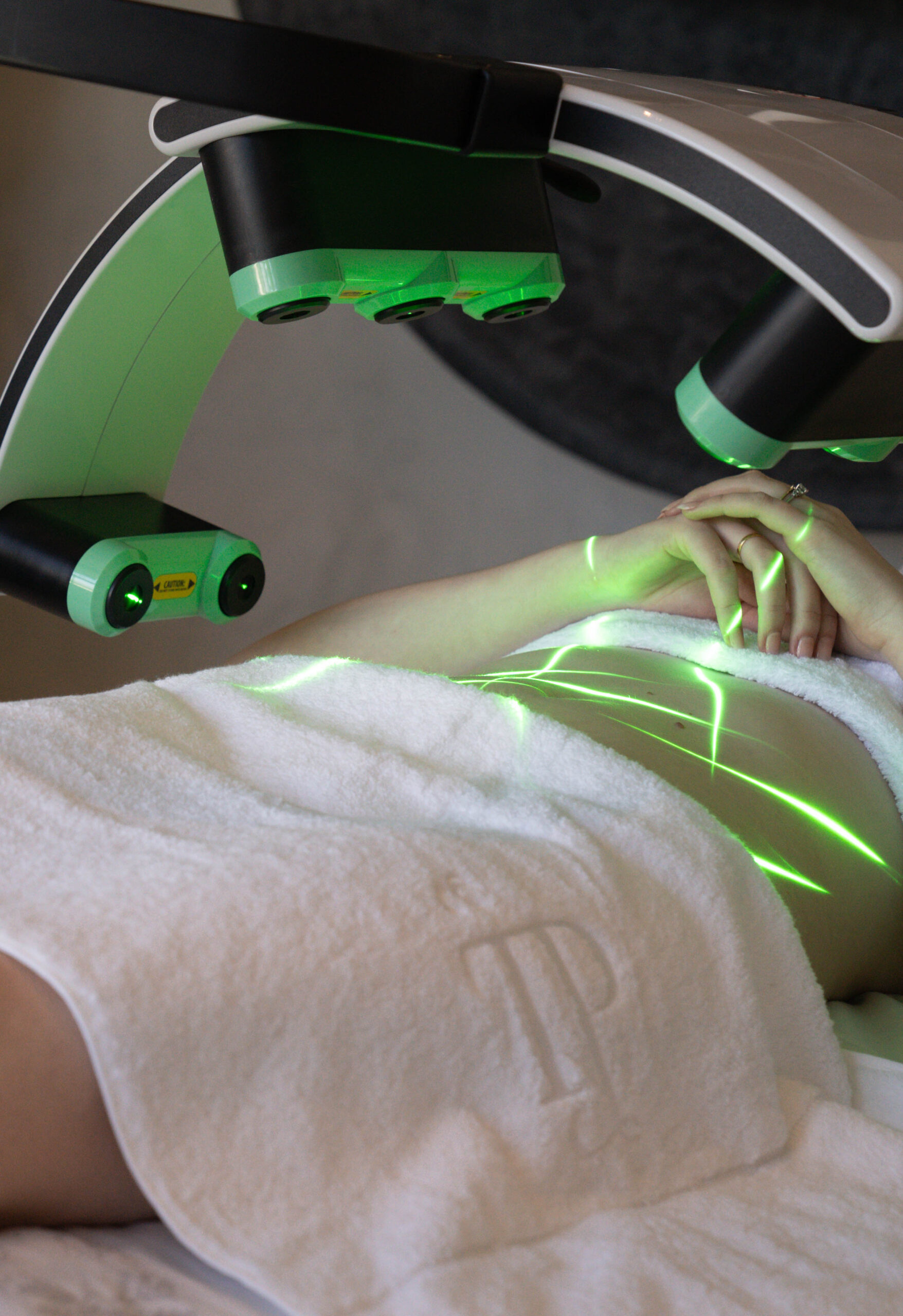 Laser Lipolysis Safety and Recovery