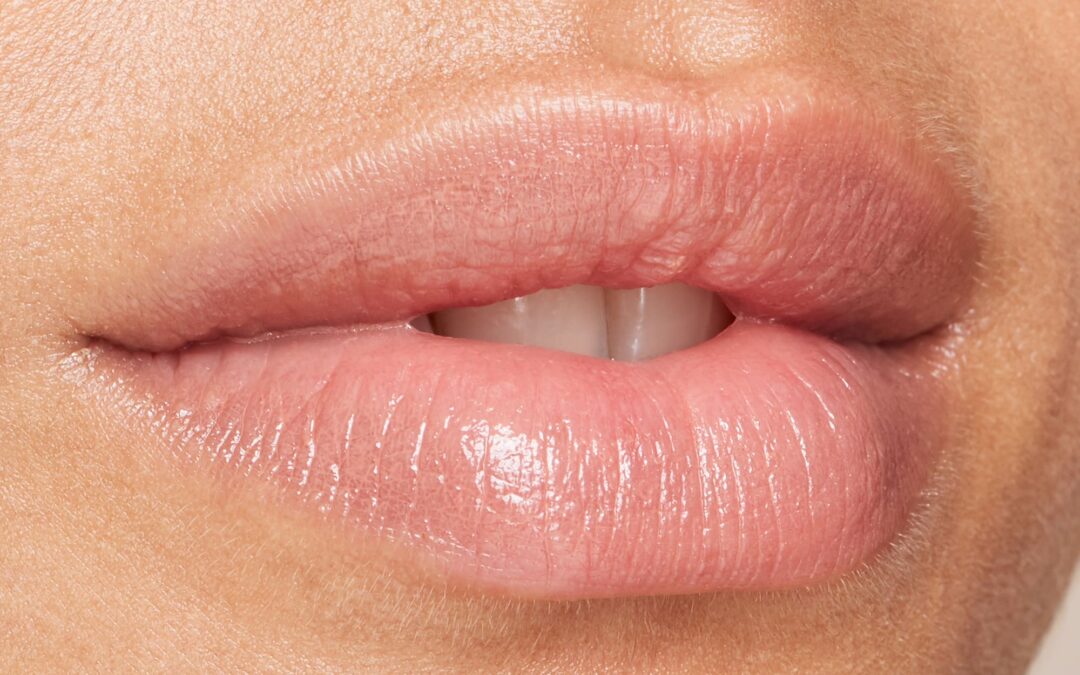 Light Touch Volumization with Volbella Fillers