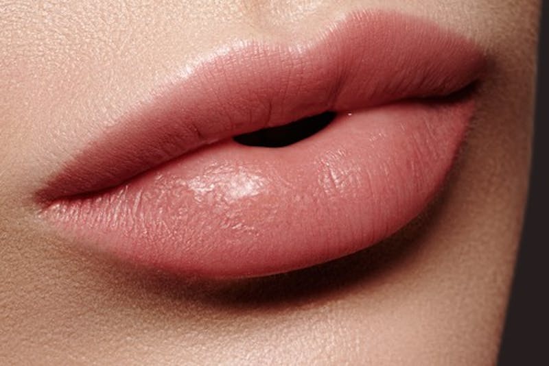 What If I Don’t Like My Lip Filler Results?