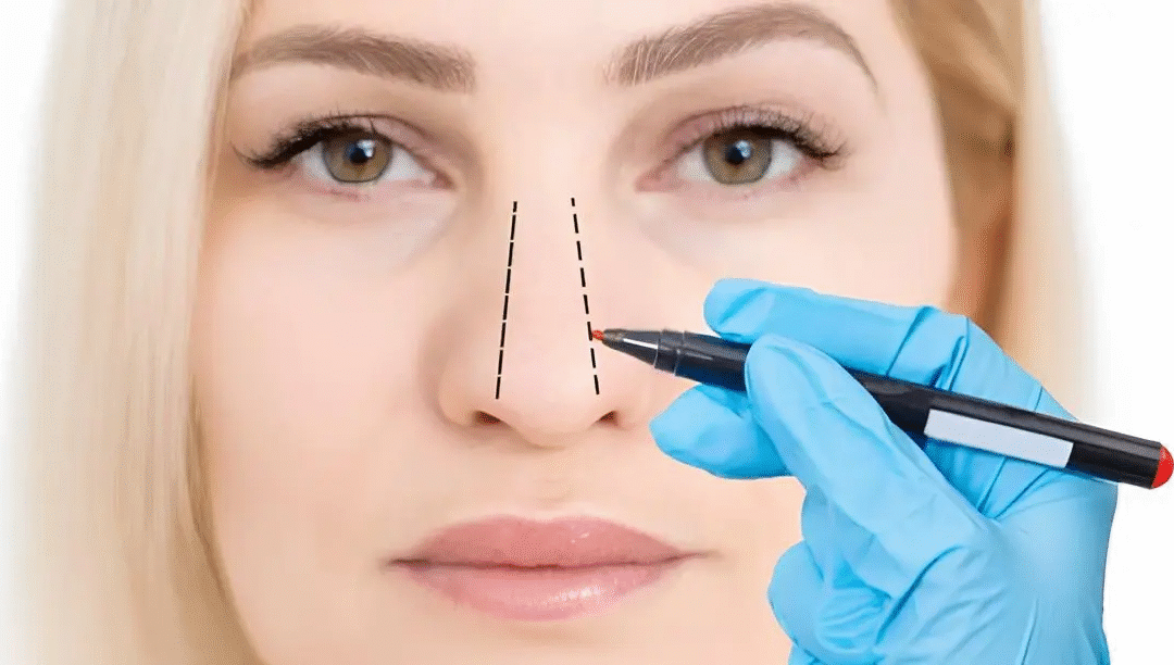 Nose Tip Correction Before and After