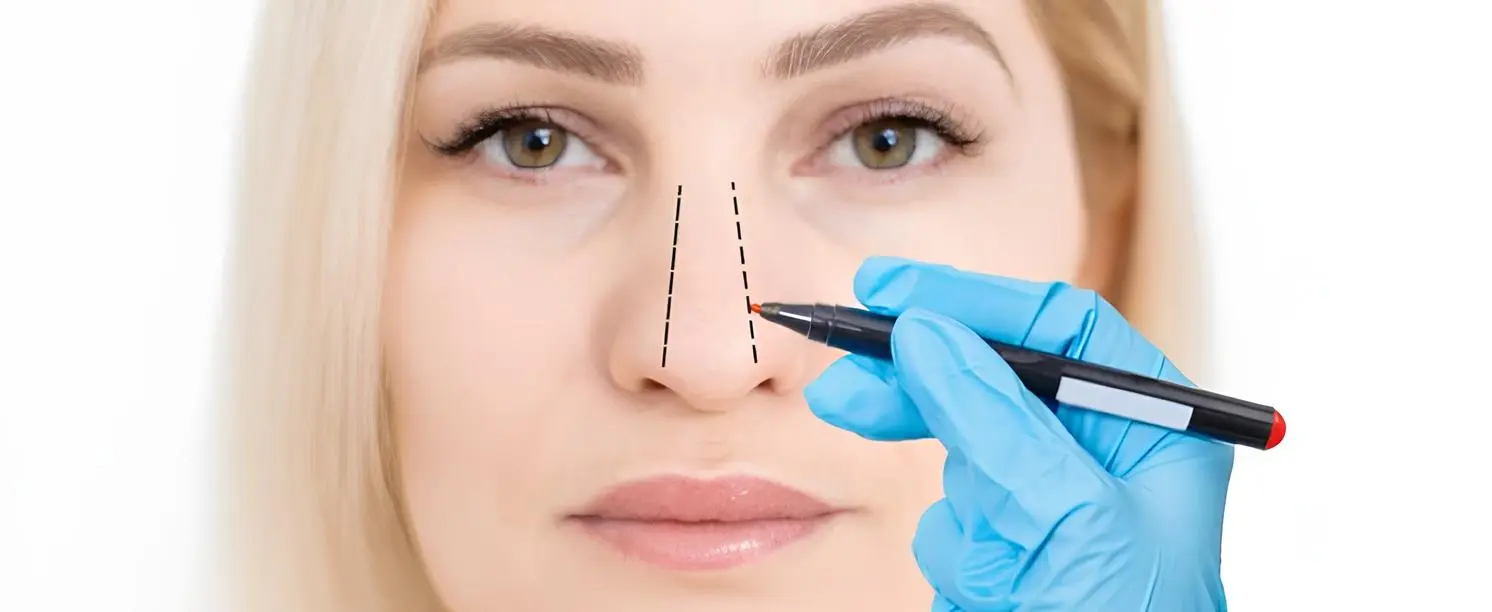 Nose Tip Correction Before and After