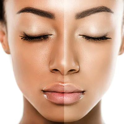 Radiant skin fast