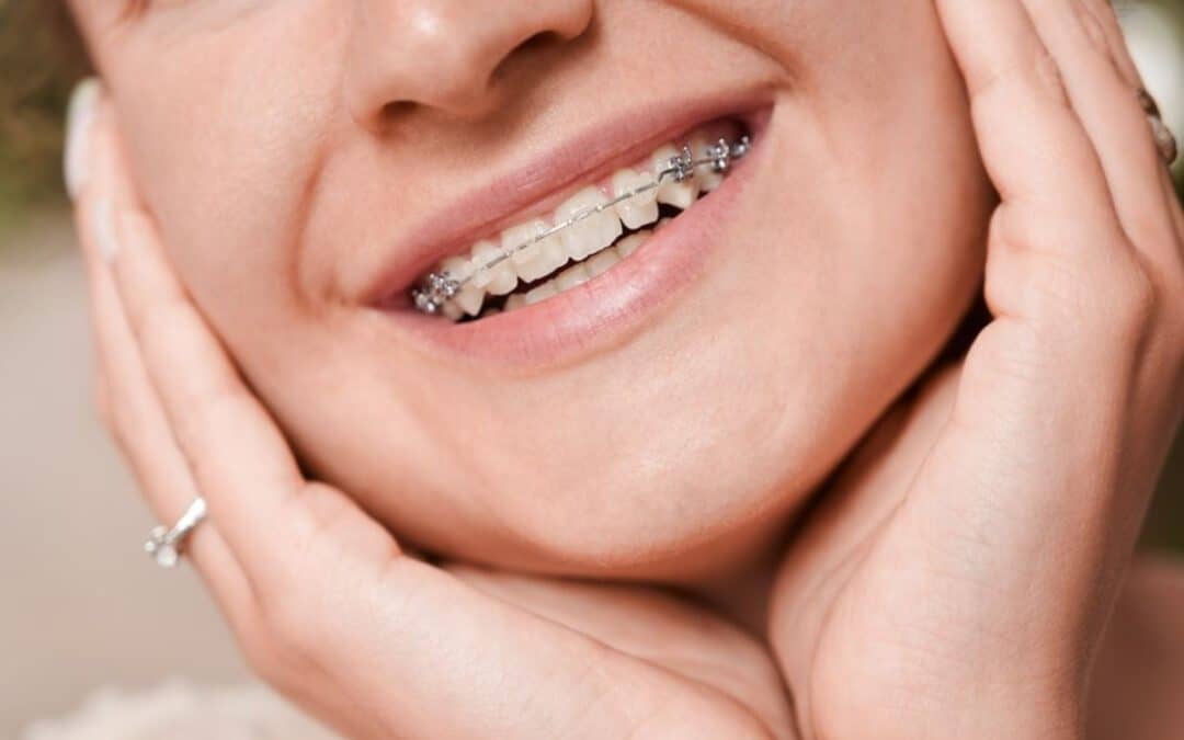 Retainers and Oral Hygiene Best Practices for a Healthy Mouth