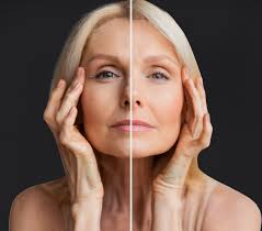 Can Microneedling Improve Skin Texture and Pores?